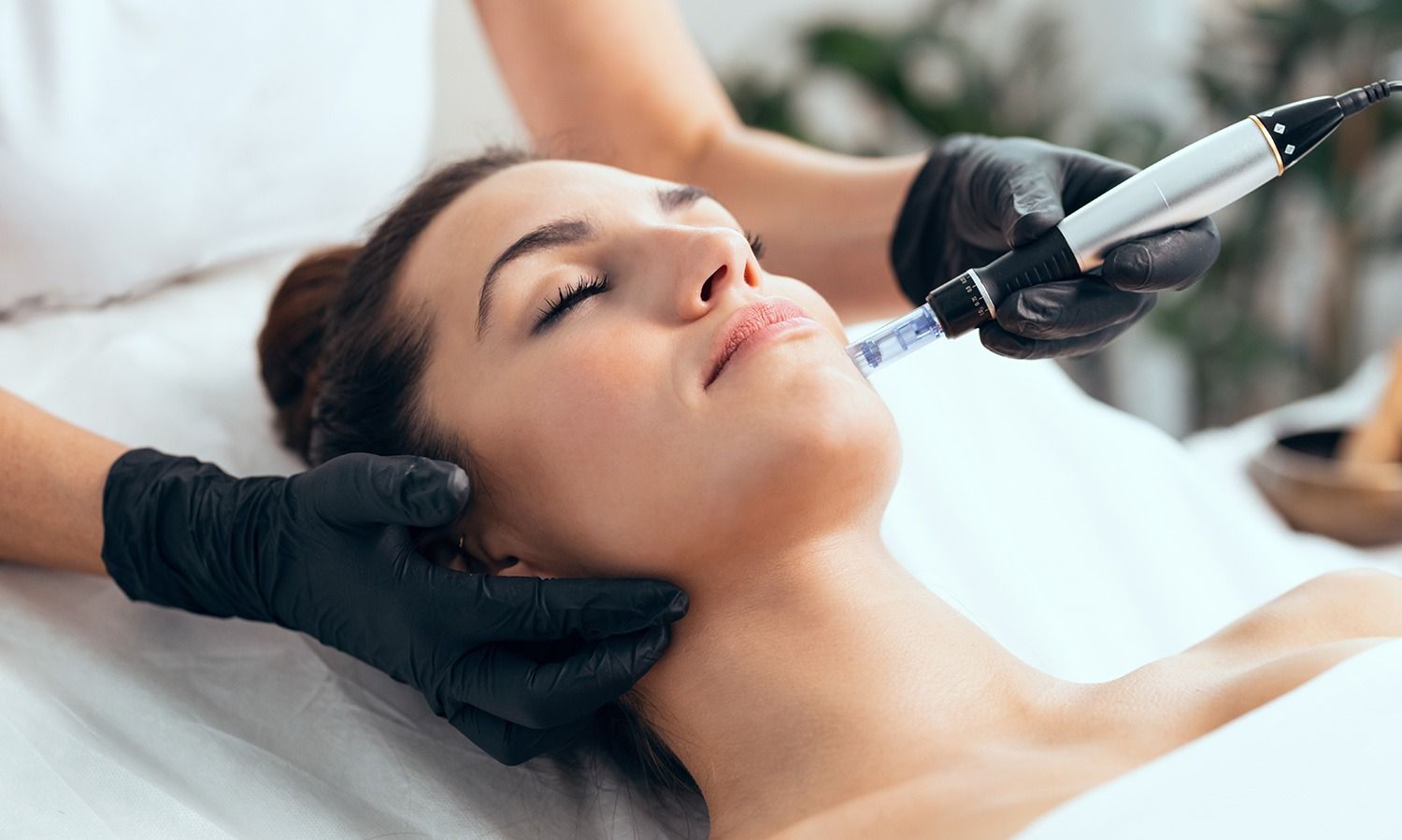 Unlocking the Secret to Glowing Skin: The Benefits of Microneedling