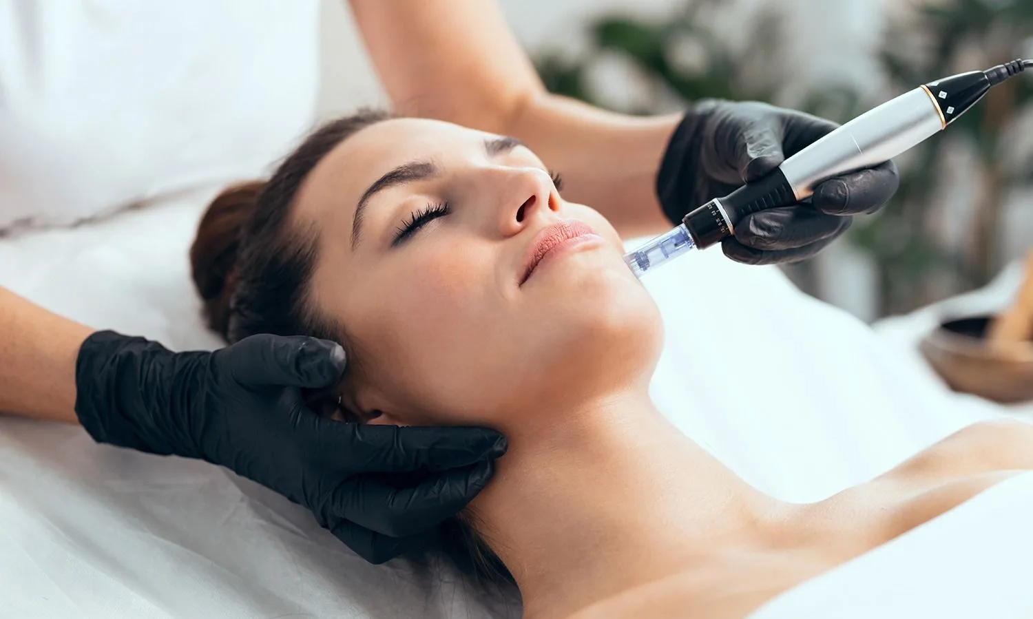 Unlocking the Secret to Glowing Skin: The Benefits of Microneedling