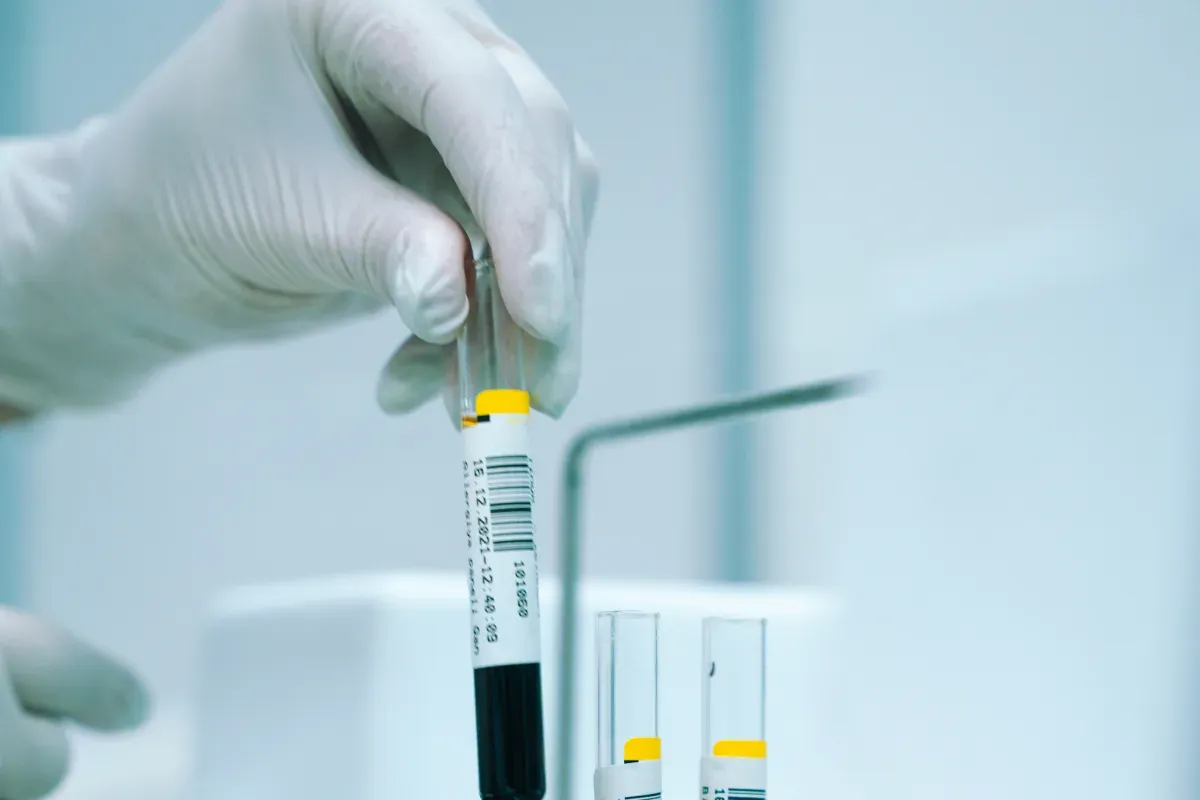 Labeled blood collection tubes at Moon Valley Med Spa